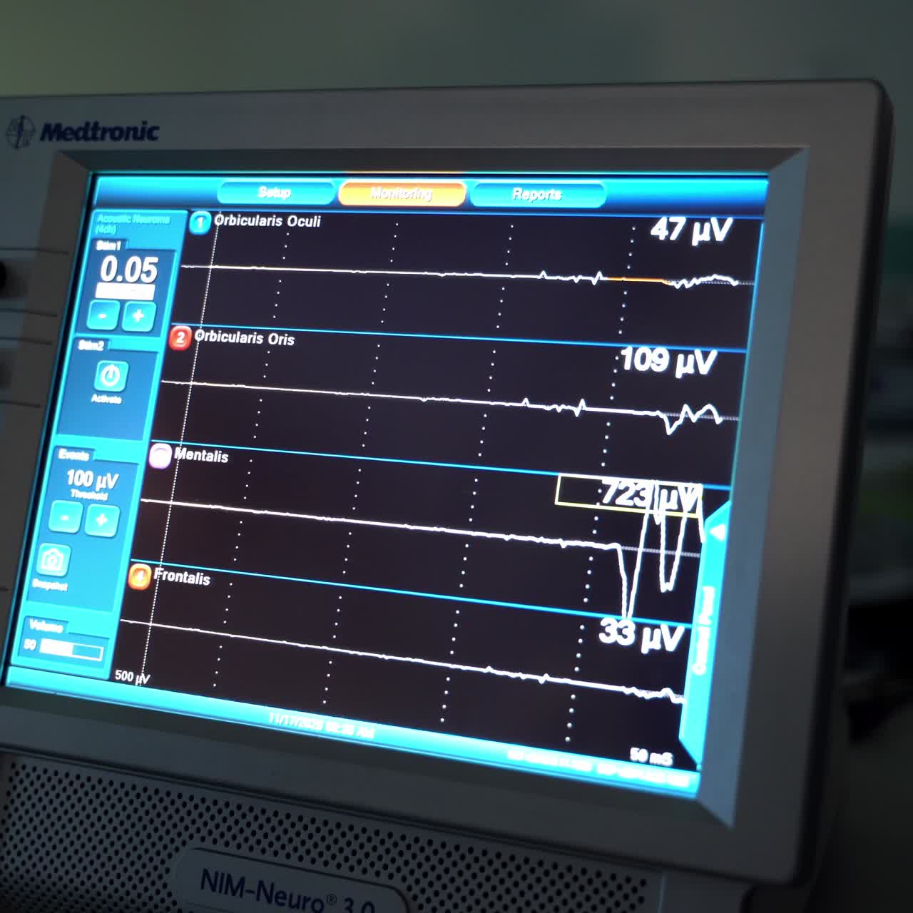 Medical helathcare monitoring system. Medicine technologies for displaying patient health