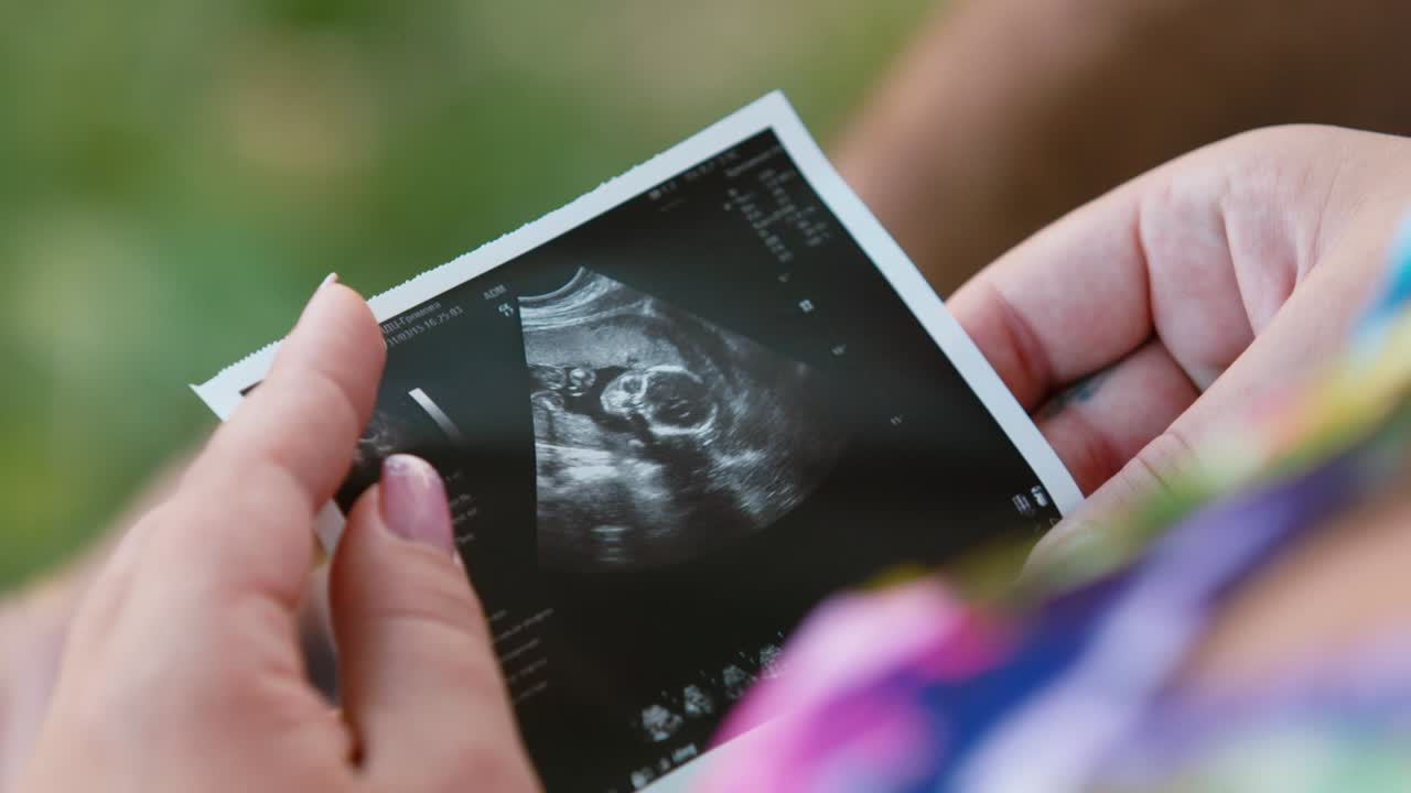 Una donna tiene un'ecografia del suo bambino tra le mani