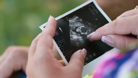 una mujer sostiene una imagen de ultrasonido de su bebé en sus manos