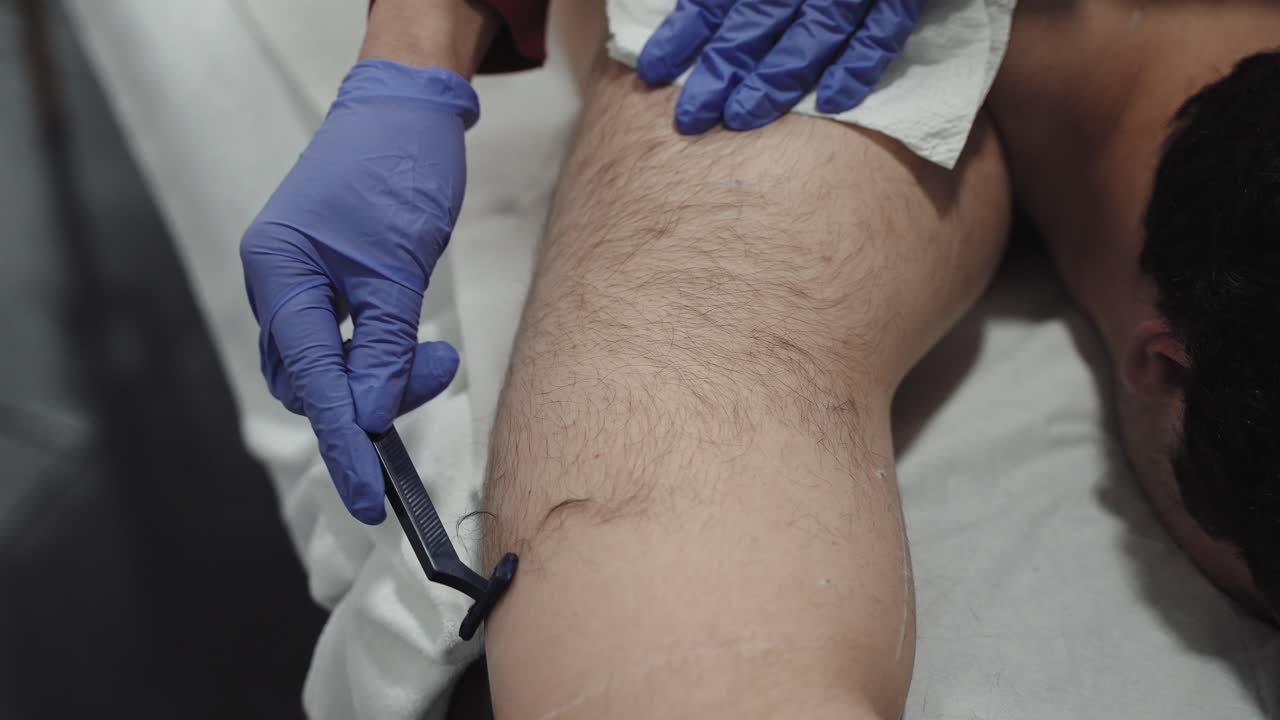 afeitarse para la depilación láser en el hombro