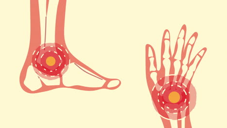 pains ankle and wrist rheumatology disease animation