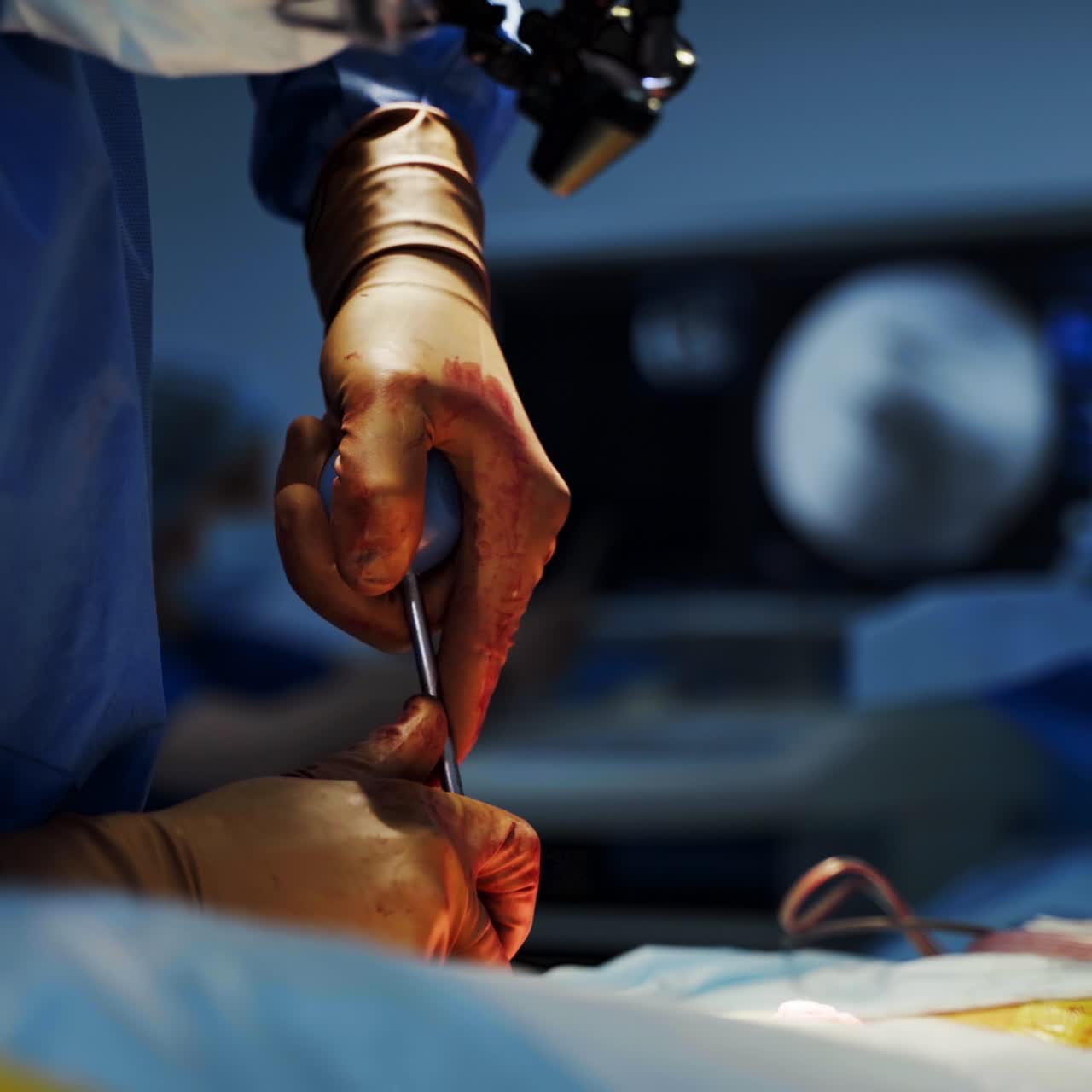 Surgical instruments in doctor's hands during operation. Surgeon and assistant in protective gloves performing a surgery on a patient. Close-up