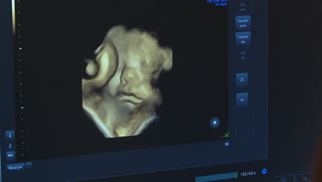 ultrasonido 3d de un feto