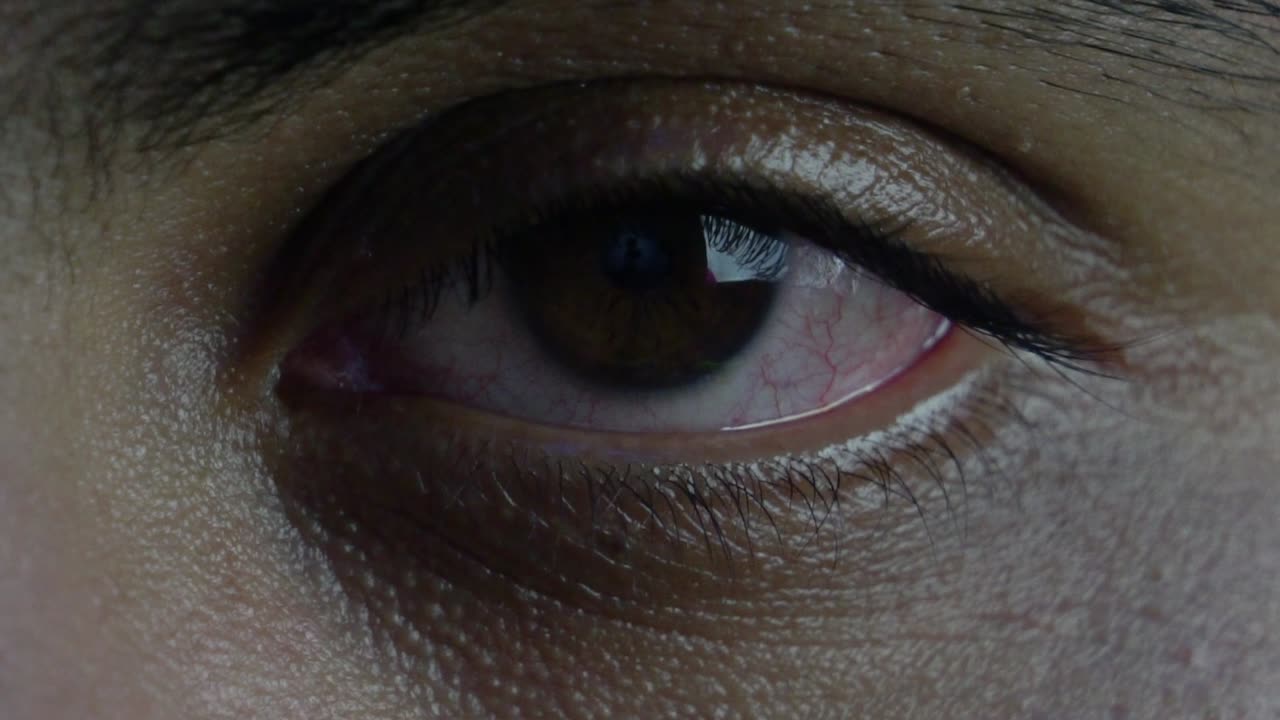 Red eyes high with weed