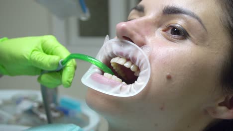 dentist using saliva ejector or dental pump to evacuate saliva. young woman with and expander in mouth at the dental clinic