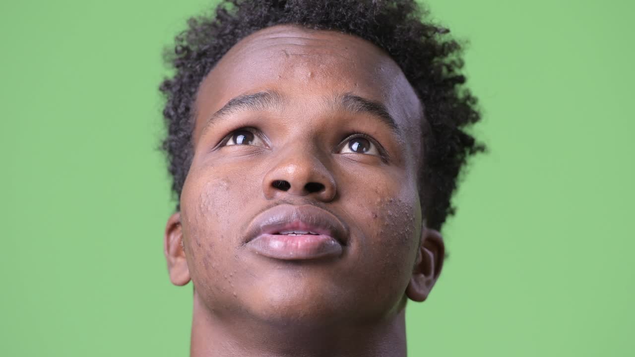 disparo en la cabeza de un joven africano