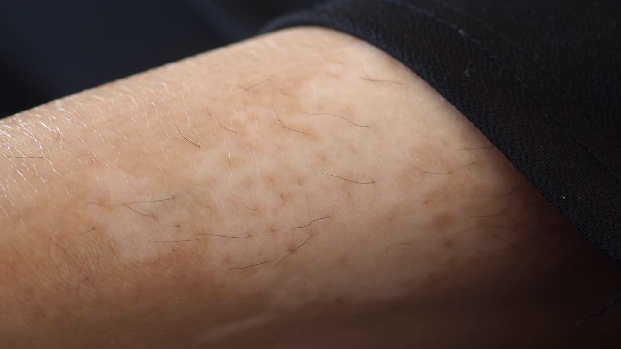 Close-up of skin and hair on a leg