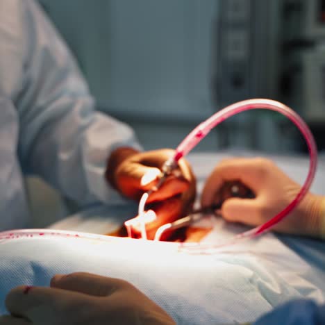 neurosurgery. operation conducted by specialists. doctor's hands in sterile gloves working with medical tools. close-up.