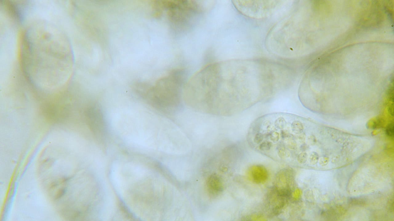 현미경 밝은 분야에서 paramecium 고밀도 인구