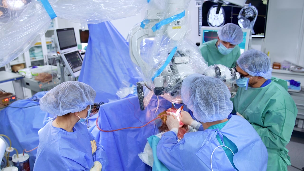 Neurokirurgisk team med tildækket mikroskop og skærme. Kirurger omkring operationsfeltet, med hjerne-MR og neuronavigationsskærme synlige på væggen bagved