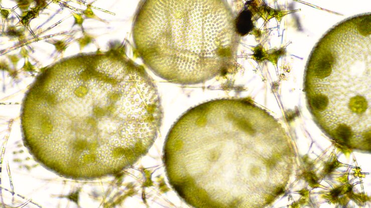 Microscopic View of Algae and Diatoms