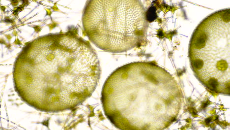 microscopic view of algae and diatoms