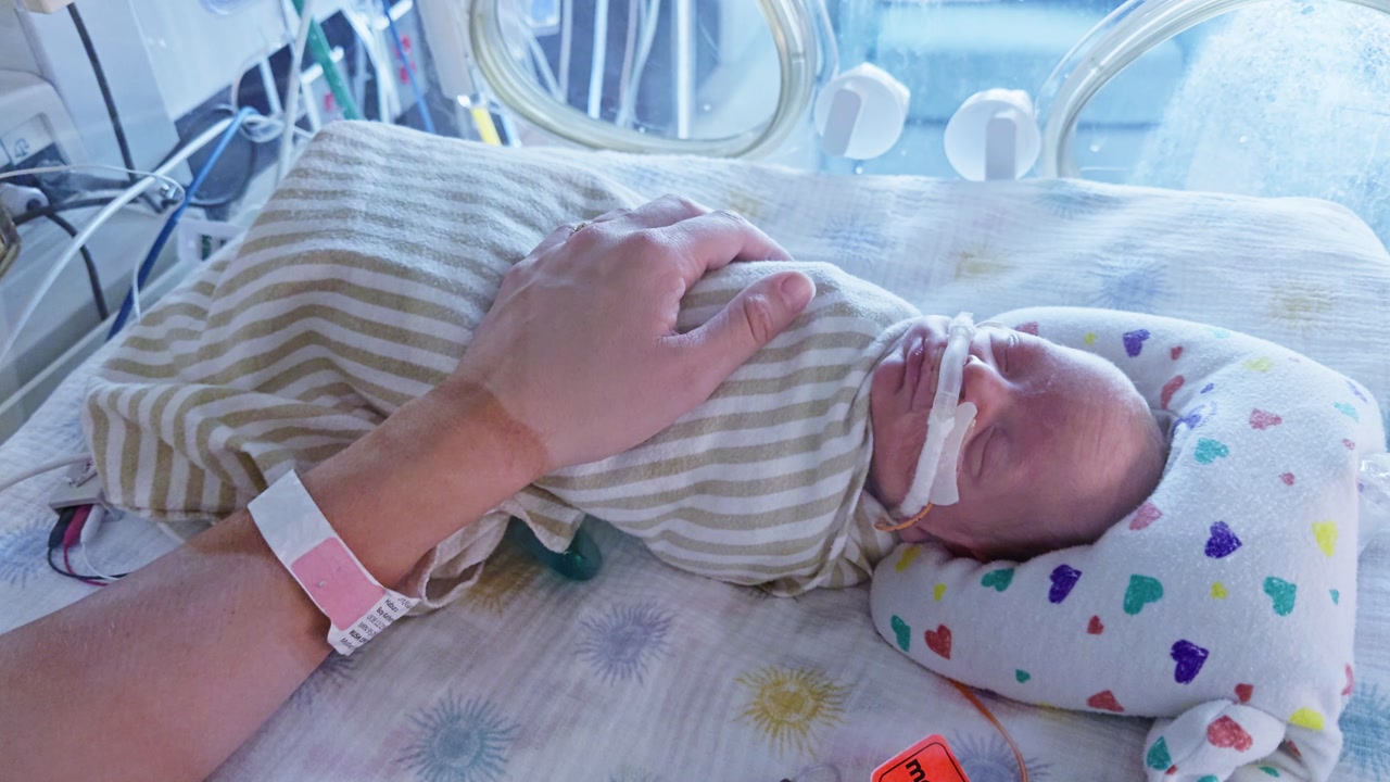 Premature newborn in striped hospital swaddle rests in NICU bassinet while parent's hand gently cradles baby's head.