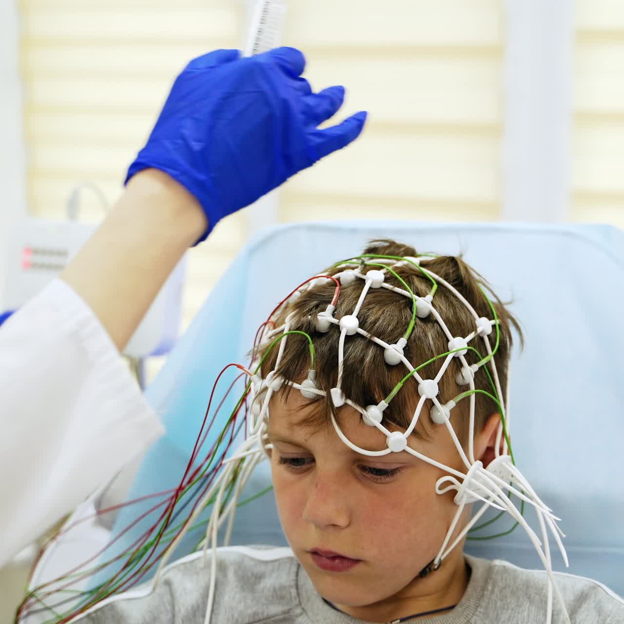 Healthcare specialist in white coat attaches sensors to the patient's head. Medic applies gel on the sensor form the syringe