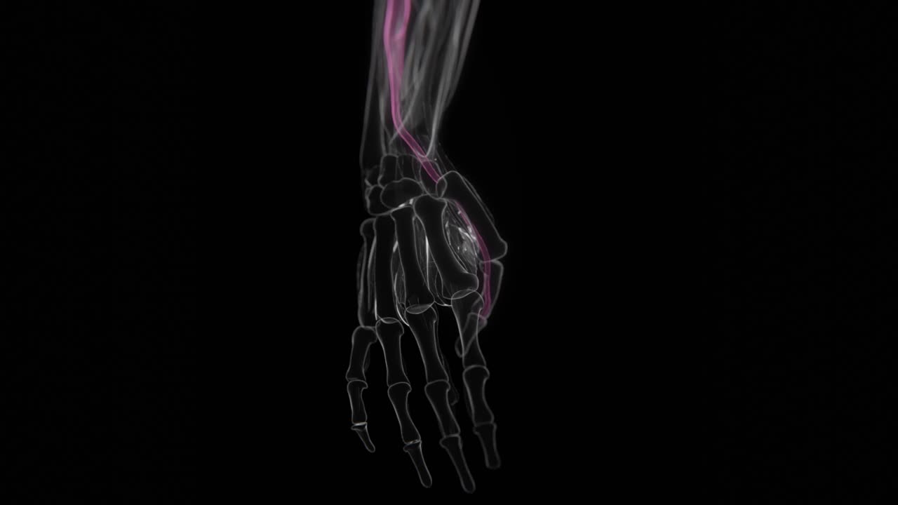 Finkelstein Test Video | Diagnosis of De Quervain's disease diagnosis X-Ray Video