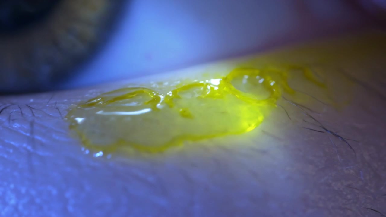 Wachsender gelber, zähflüssiger Tropfen breitet sich unter kühlem blauem Licht über das untere Augenlid und die Wange aus, am Auge.