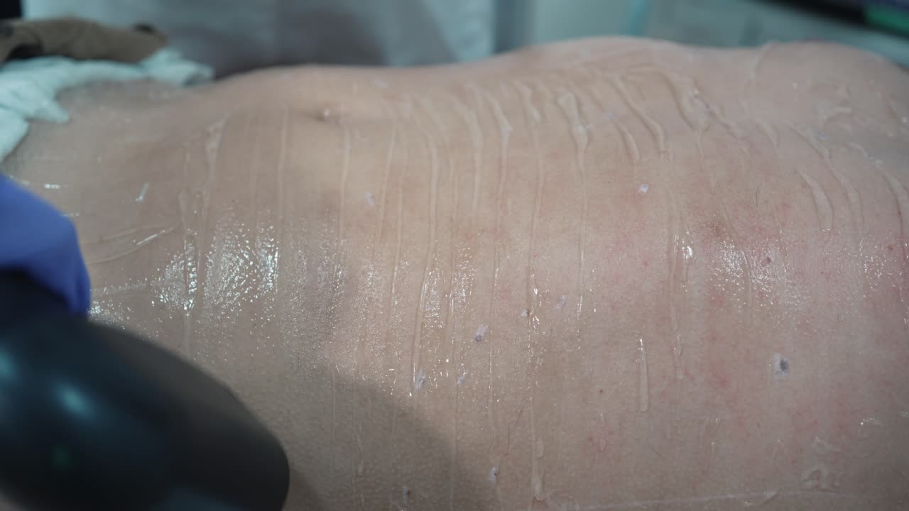 depilación láser en la piel detallada del torso - de cerca