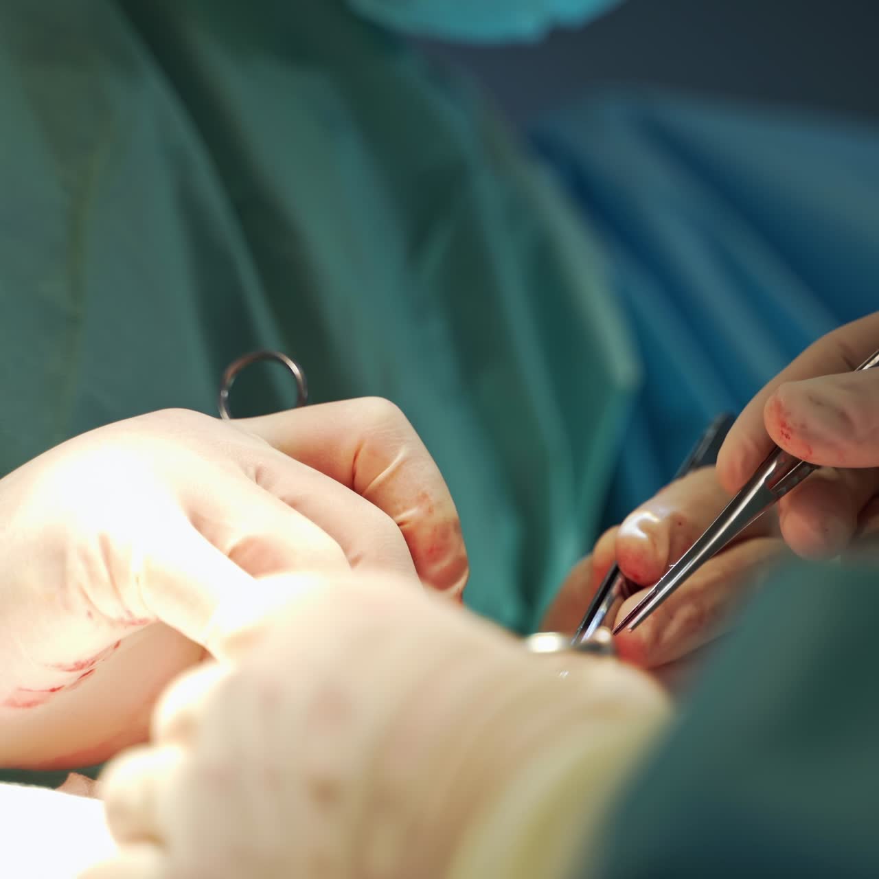 Gloved hands of one doctor use forceps at operation. The other surgeon applies scissors. Close up. Blurred backdrop