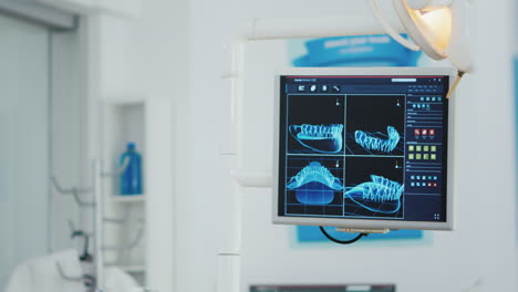 Primer-Plano-De-La-Radiografía-De-Los-Dientes-En-El-Monitor-En-La-Oficina-Luminosa-Del-Moderno-Hospital-De-Ortodoncia-Y-Estomatología.