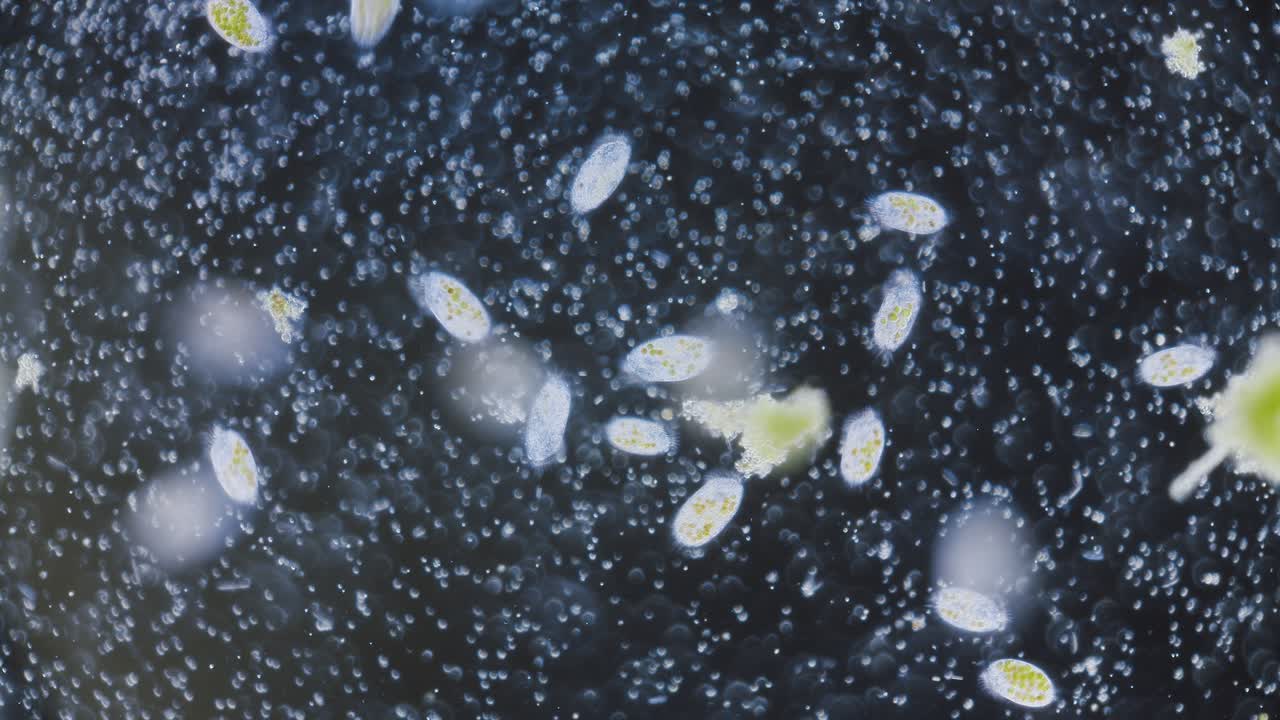 Yksisoluinen paramesium, jonka sisällä on symbioottinen levä