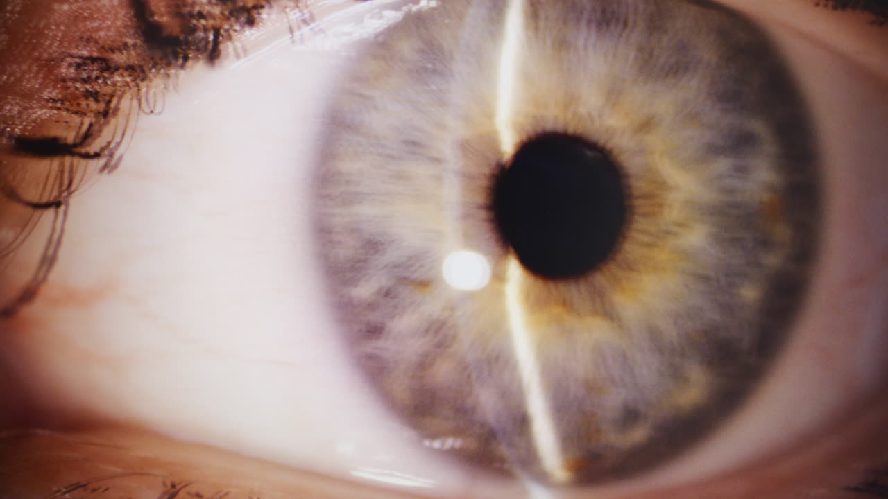 Close-up of Woman's Eye During Examination
