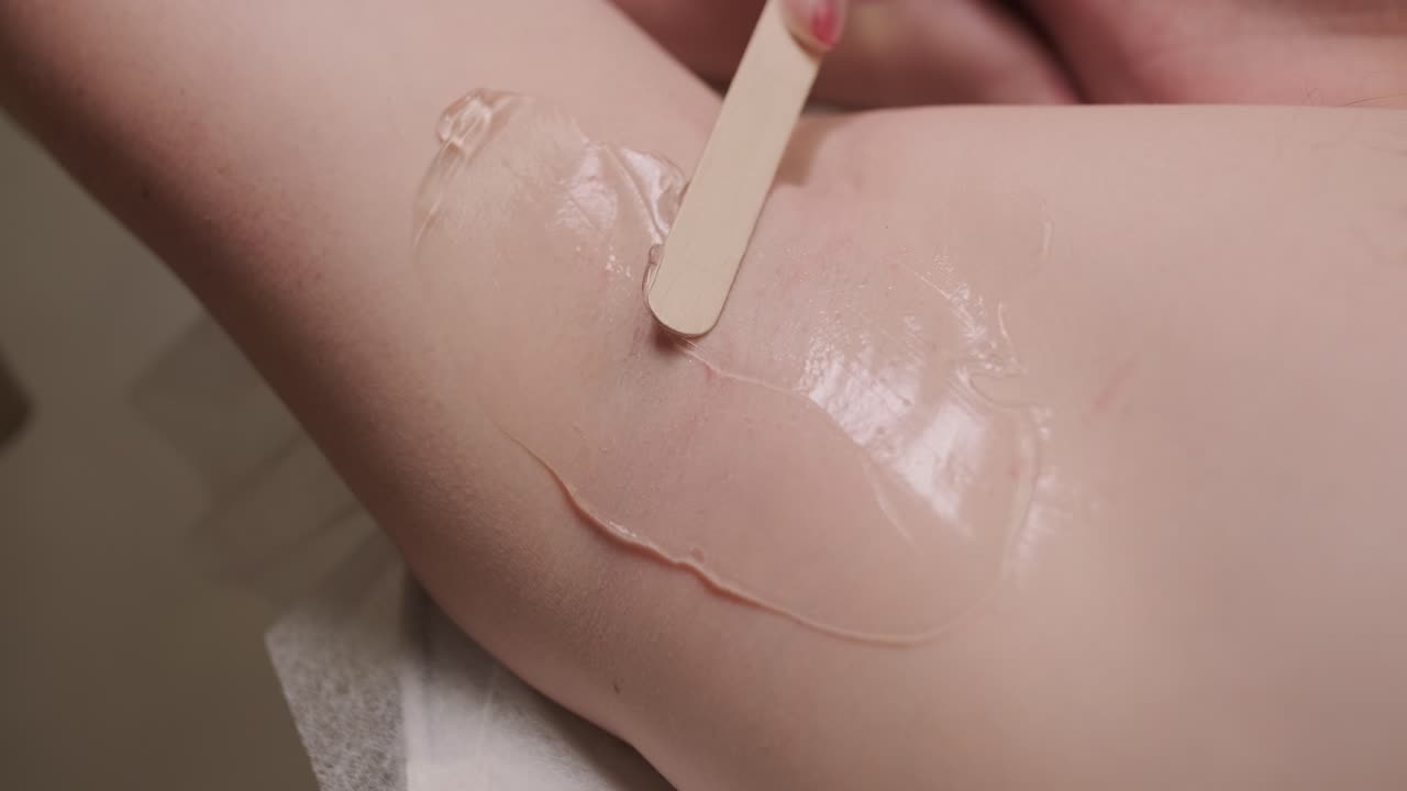 un hombre que se somete a un tratamiento de depilación láser en el pecho con un técnico profesional en una clínica