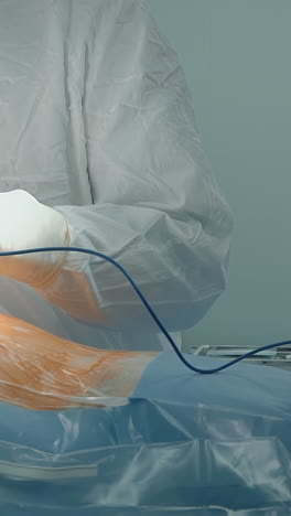 el médico utiliza el bisturí láser en el cuarto de cirugía de cerca. el cirujano cardiólogo corta los tejidos del cuerpo del paciente con un cortador en el hospital. cirugía de derivación de la arteria coronaria