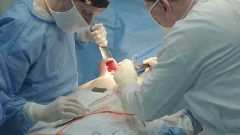 breast removal surgery under the guidance surgeons team, preparation for breast implant placement