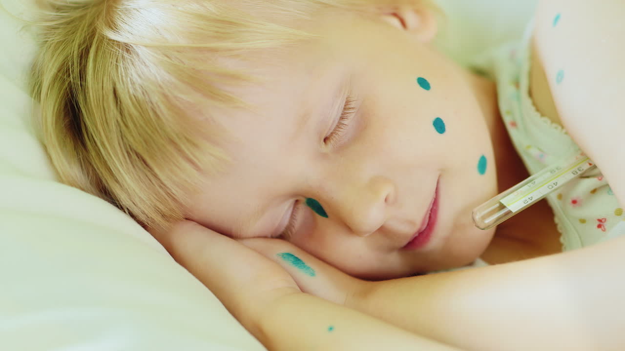 수두 2에 걸린 소녀