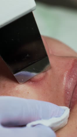 gloved hands of beautician move ultrasonic scrubber by the face of caucasian woman. salon skincare concept. extreme close up. vertical video