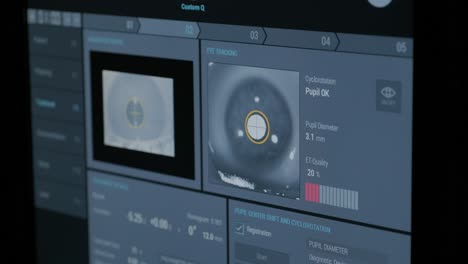 ophthalmic surgery. view on the screen of medical monitor in operating room. eye tracking