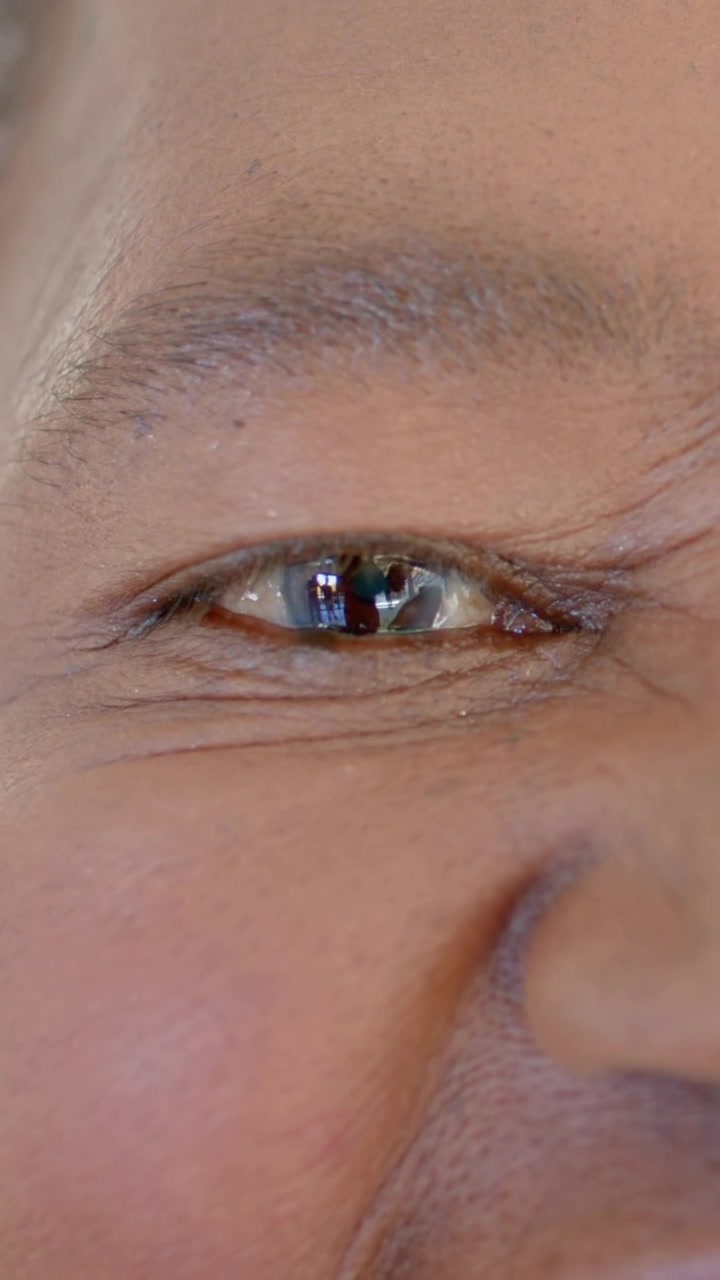 Video verticale: Donna che registra, che sbatte l'occhio destro, strizza gli occhi a casa, con il telefono che si riflette nella cornea.
