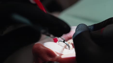 dentist performing operation. medical treatment at the dentist office
