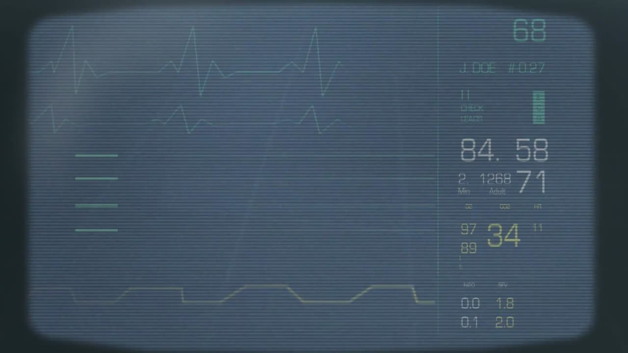 데이터 차트 와 다이어그램 이 오래된 tv 스크린 에서 나타나고 사라지고 있다