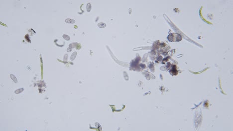 diferentes especies de agua dulce de protozoos organismos unicelulares como estentores, ciliados y movimiento de algas bajo el microscopio vista archivada brillante