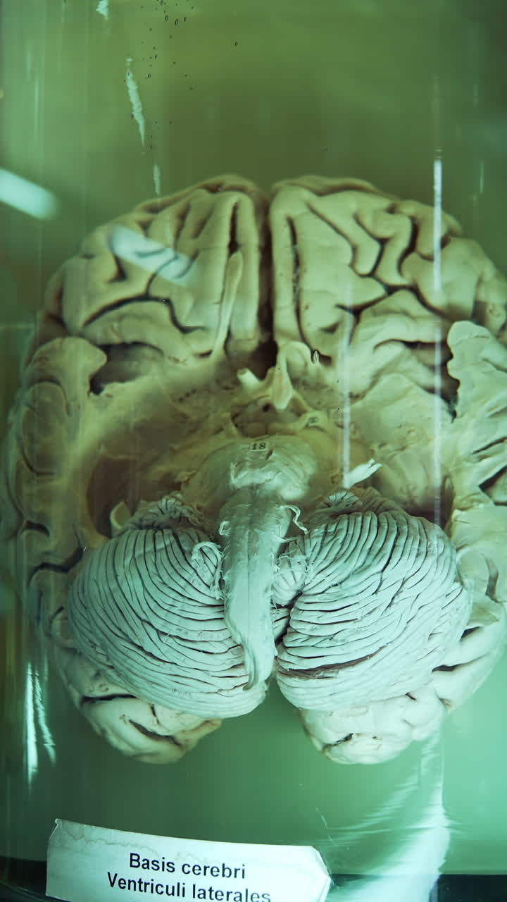 Model of human brain in medical museum. Internal organ preserved in formalin. Anatomical model of cerebrum in laboratory. Close-up. Vertical video