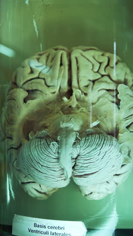 model of human brain in medical museum. internal organ preserved in formalin. anatomical model of cerebrum in laboratory. close-up. vertical video