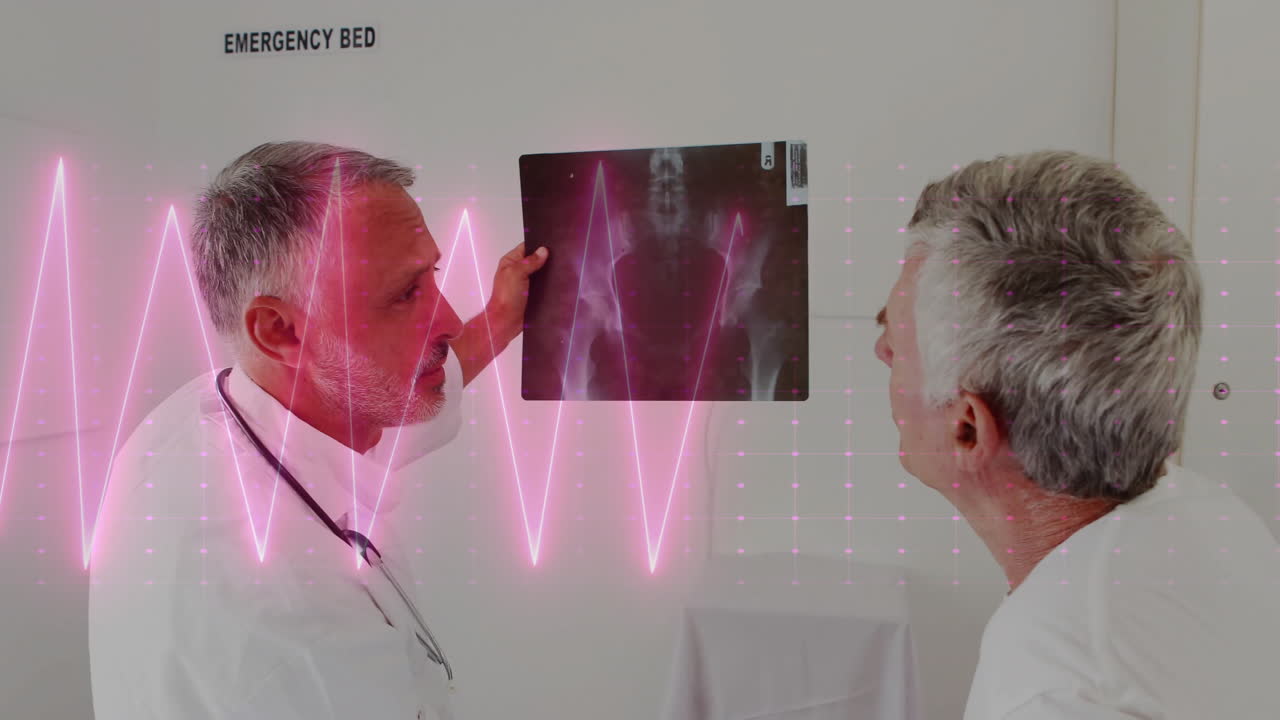 Animation of cardiograph over caucasian male doctors holding xray