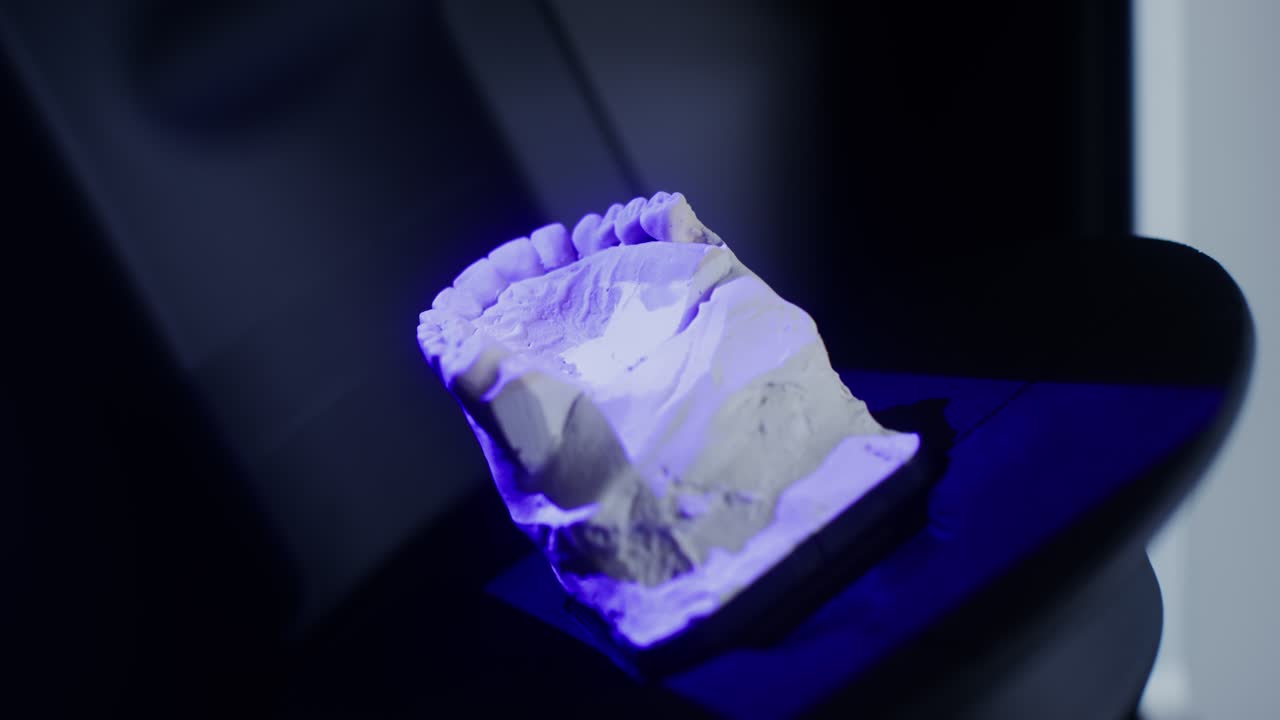 3d 인쇄된 치아 모델