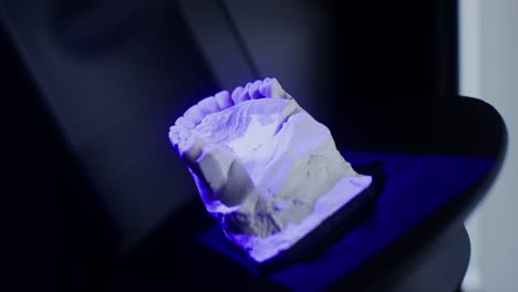 modelo dental impreso en 3d
