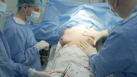 외과 수술실에서 수술팀의 지도하에 유방 증강