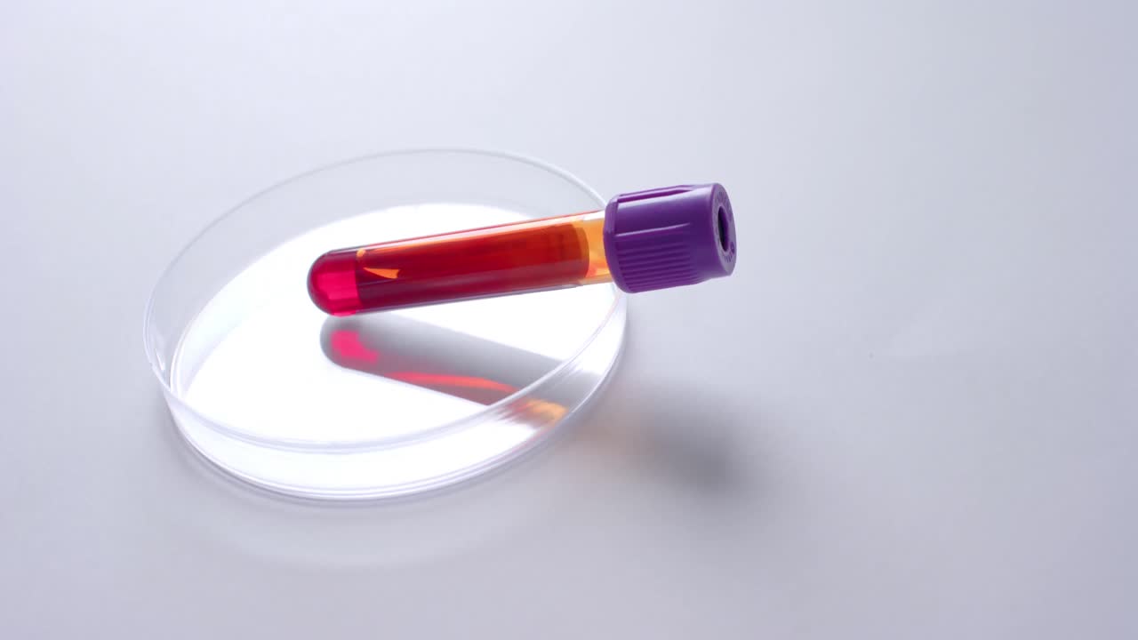 primer plano de una muestra de sangre y una placa de petri sobre un fondo blanco con espacio de copia, cámara lenta