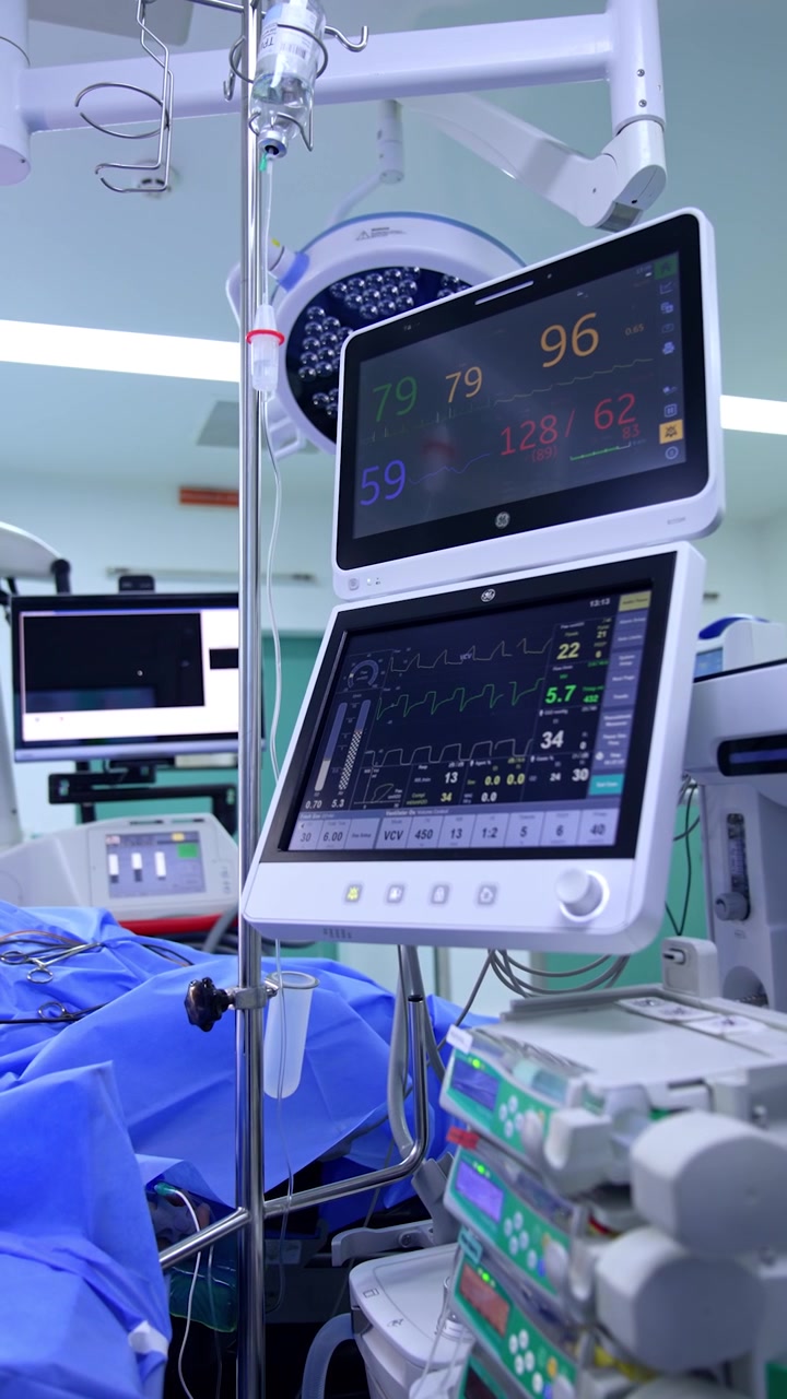 Moderne attrezzature mediche in funzione nella sala operatoria durante un intervento. Pompe per infusione, ventilatore polmonare e contagocce sul tavolo operatorio. Video verticale.