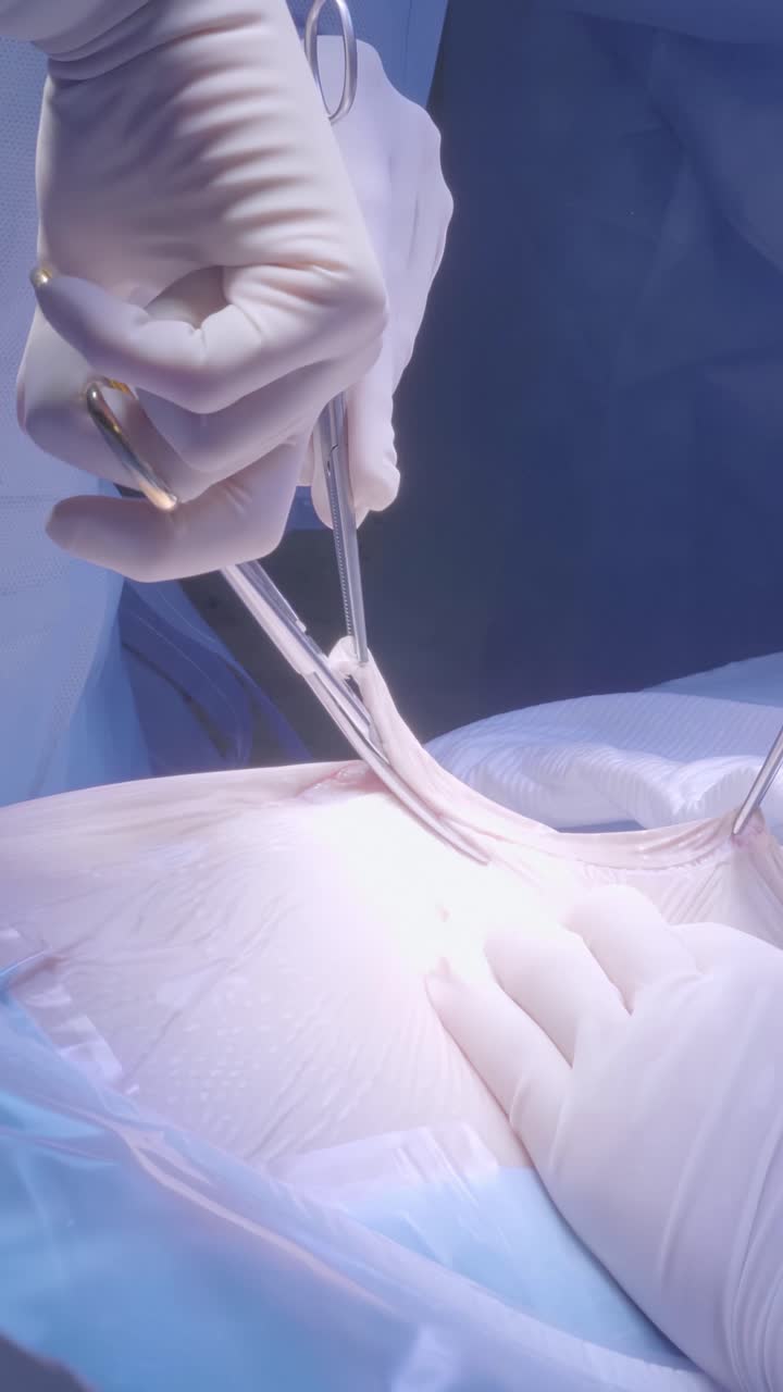 Surgical hands in sterile gloves performing delicate procedure with surgical instruments and light