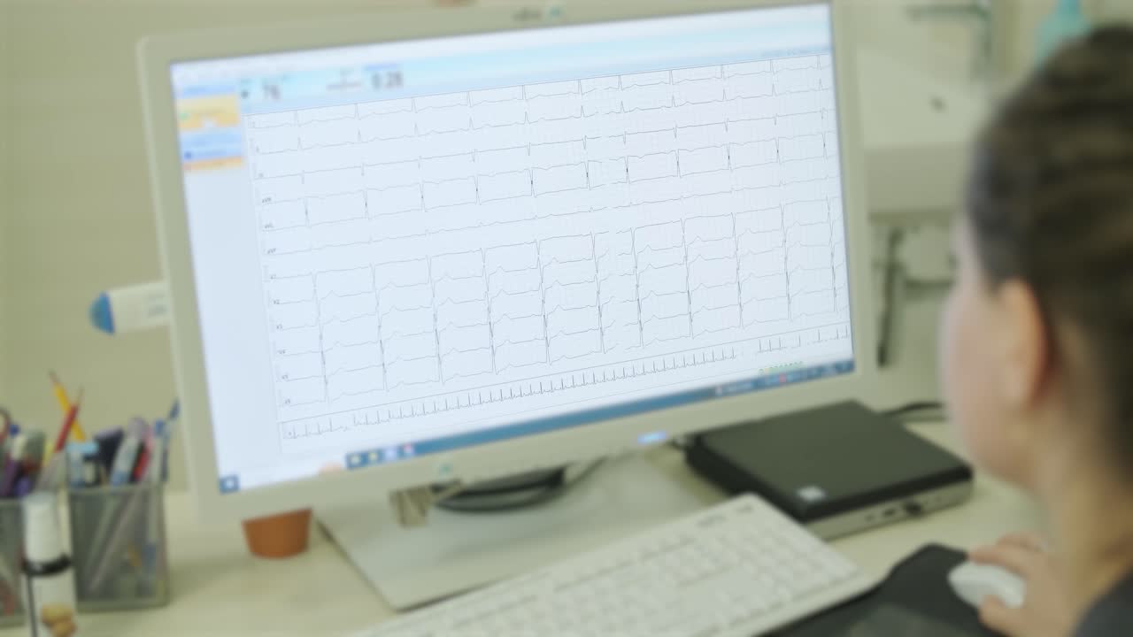 paciente sometido a monitoreo de ecg en un entorno médico