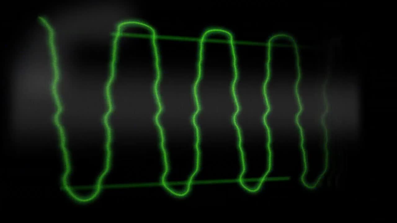 어두운 배경에서 움직이는 초록색 선의 애니메이션