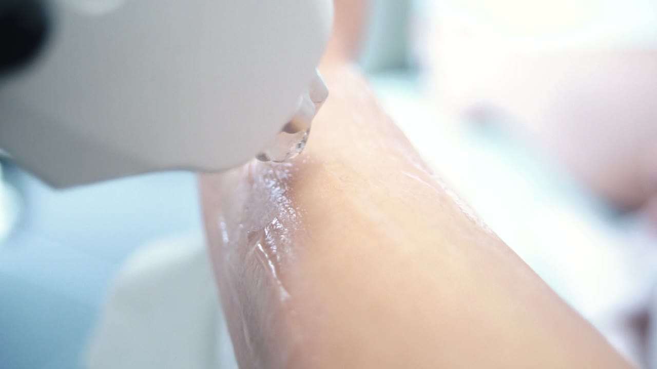 레이저 탈모 절차