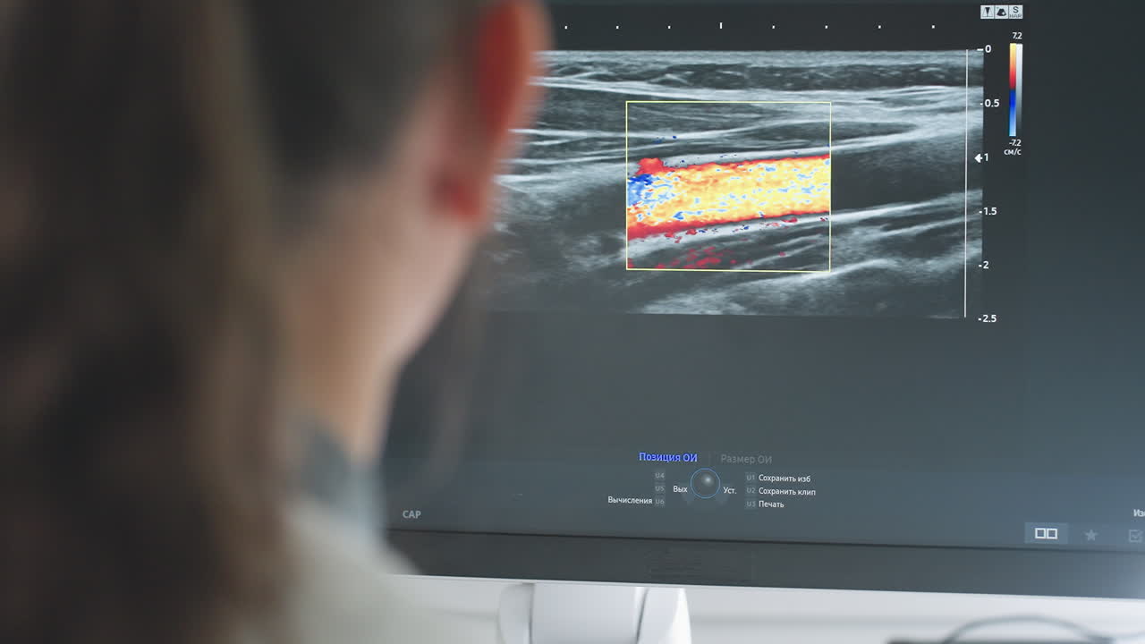 Faint image of diagnostic radiographer closely monitoring radiography machine screen displaying vivid real-time color flow imaging data during medical examination, focusing on patient diagnosis