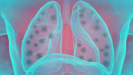 Sistema-Respiratorio-Infectado-Por-La-Enfermedad-Del-Virus-De-La-Corona