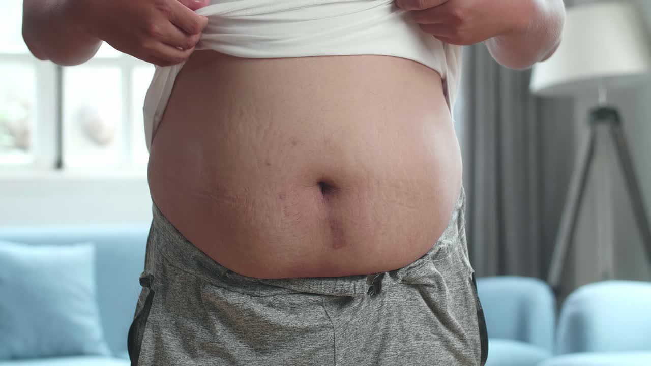 primer plano de un hombre gordo que muestra su grasa abdominal